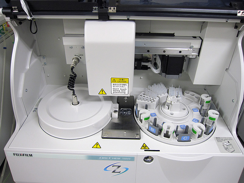 血液生化学検査器